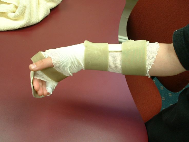 Is A Dorsal Root Ganglion Block Right For You? Ask A Pain Doctor Singapore